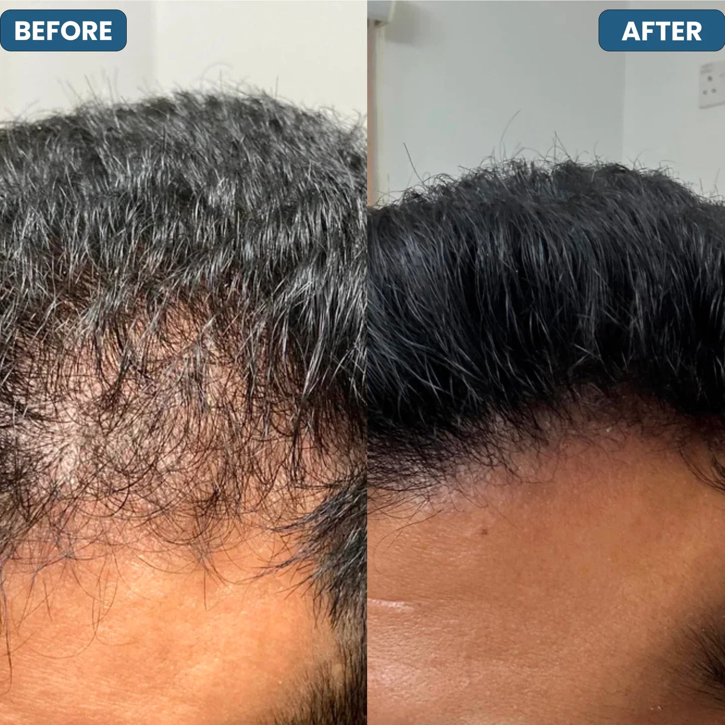 HAIR GROWTH SERUM ROLLER