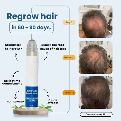 HAIR GROWTH SERUM ROLLER